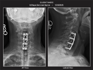 Medical exhibit sample 1