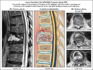 Medical exhibit sample 2