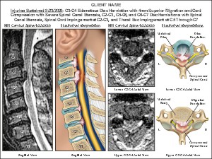 Medical exhibit sample 5