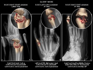 Medical exhibit sample 3