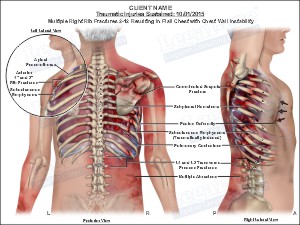 Medical exhibit sample 4