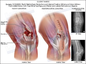 Medical exhibit sample 7