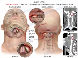 Medical exhibit sample 8