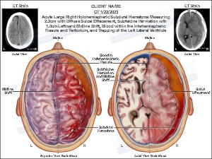 Medical exhibit sample 9