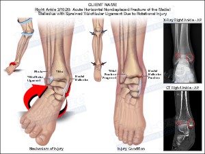 Medical exhibit sample 6