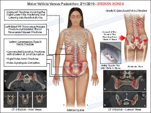Medical exhibit sample 12