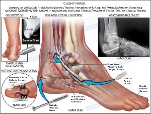 Medical exhibit sample 10